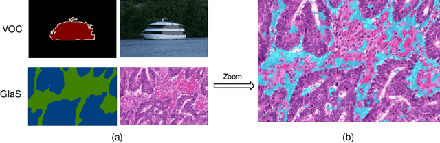 Figure 1 for Online Easy Example Mining for Weakly-supervised Gland Segmentation from Histology Images