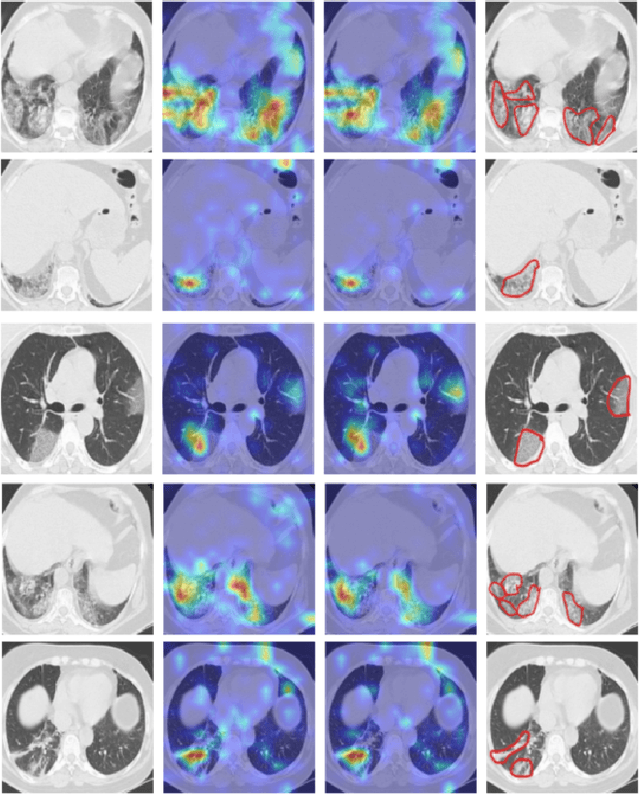 Figure 2 for COVID CT-Net: Predicting Covid-19 From Chest CT Images Using Attentional Convolutional Network