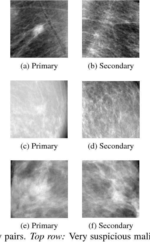 Figure 1 for Classifying Symmetrical Differences and Temporal Change in Mammography Using Deep Neural Networks