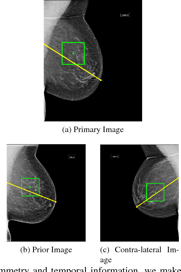 Figure 4 for Classifying Symmetrical Differences and Temporal Change in Mammography Using Deep Neural Networks