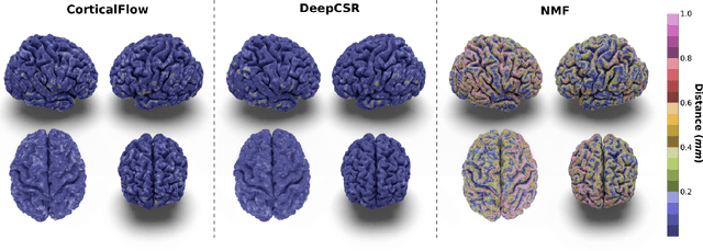 Figure 4 for CorticalFlow: A Diffeomorphic Mesh Deformation Module for Cortical Surface Reconstruction