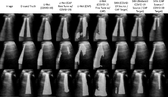 Figure 4 for Lung Ultrasound Segmentation and Adaptation between COVID-19 and Community-Acquired Pneumonia