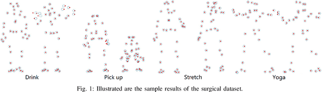 Figure 1 for A closed-form solution to estimate uncertainty in non-rigid structure from motion