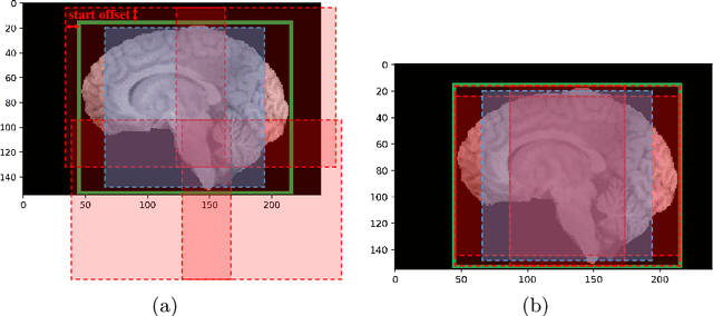 Figure 3 for Brain-wise Tumor Segmentation and Patient Overall Survival Prediction