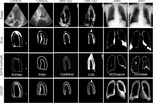 Figure 3 for CRISP - Reliable Uncertainty Estimation for Medical Image Segmentation