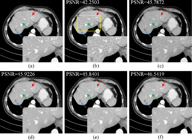 Figure 2 for Low-Dose CT Image Denoising Using Parallel-Clone Networks