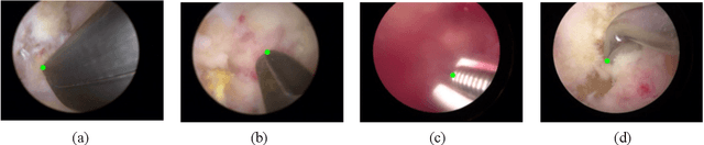 Figure 3 for Automatic Tip Detection of Surgical Instruments in Biportal Endoscopic Spine Surgery