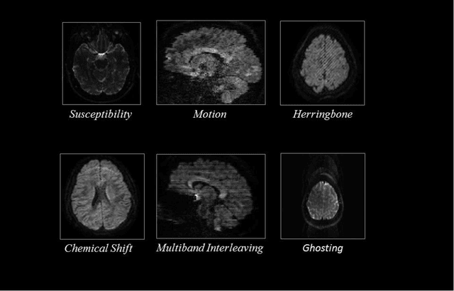 Figure 2 for QC-Automator: Deep Learning-based Automated Quality Control for Diffusion MR Images