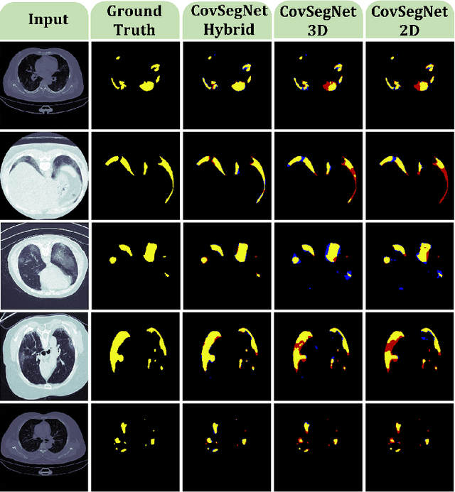 Figure 2 for CovSegNet: A Multi Encoder-Decoder Architecture for Improved Lesion Segmentation of COVID-19 Chest CT Scans