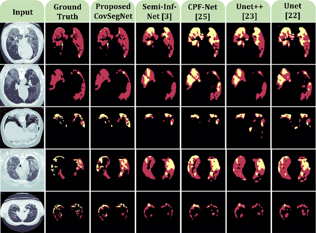 Figure 3 for CovSegNet: A Multi Encoder-Decoder Architecture for Improved Lesion Segmentation of COVID-19 Chest CT Scans