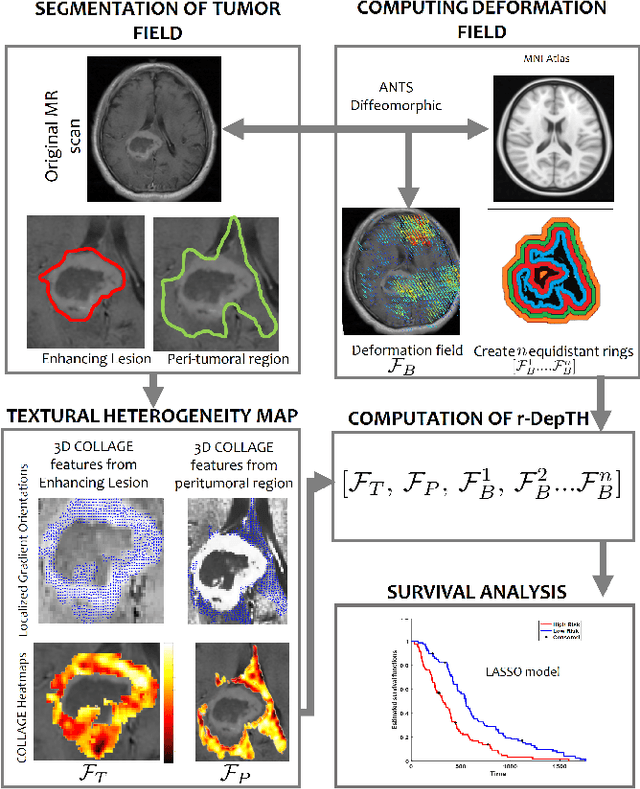 Figure 1 for Radiomic Deformation and Textural Heterogeneity (R-DepTH) Descriptor to characterize Tumor Field Effect: Application to Survival Prediction in Glioblastoma