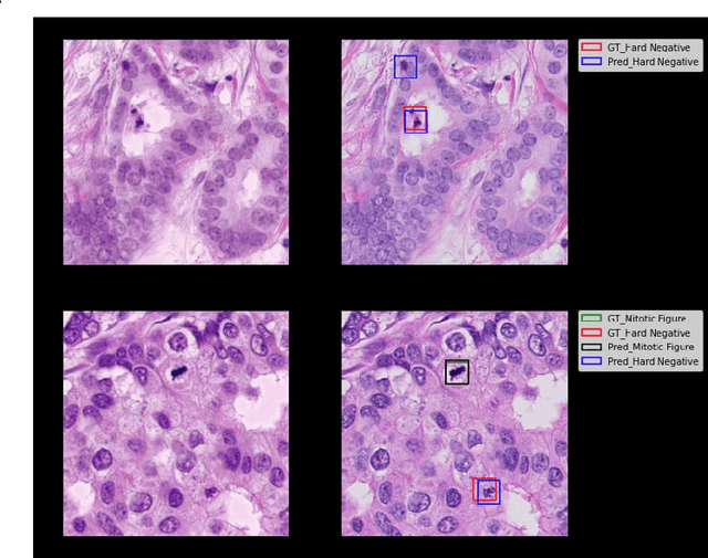 Figure 4 for Improving Mitosis Detection Via UNet-based Adversarial Domain Homogenizer
