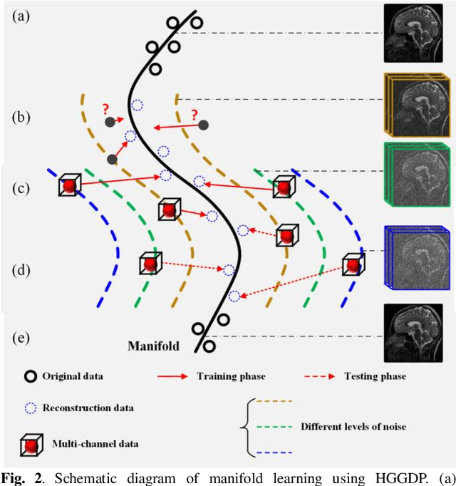 Figure 4 for Homotopic Gradients of Generative Density Priors for MR Image Reconstruction