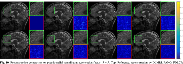 Figure 2 for Homotopic Gradients of Generative Density Priors for MR Image Reconstruction