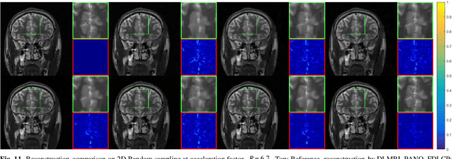 Figure 3 for Homotopic Gradients of Generative Density Priors for MR Image Reconstruction