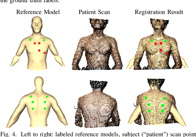 Figure 4 for Automated Heart and Lung Auscultation in Robotic Physical Examinations