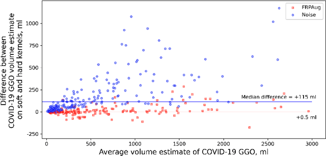 Figure 1 for Zero-Shot Domain Adaptation in CT Segmentation by Filtered Back Projection Augmentation