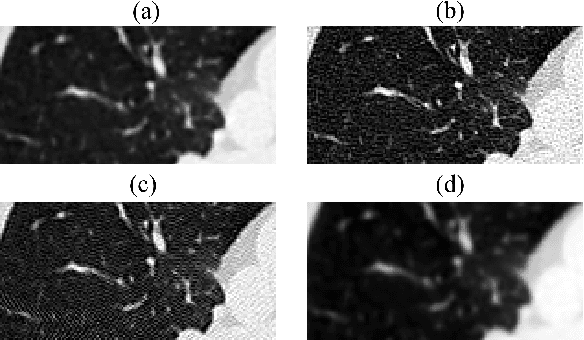 Figure 3 for Zero-Shot Domain Adaptation in CT Segmentation by Filtered Back Projection Augmentation