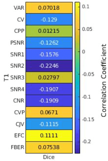 Figure 3 for Correlation between image quality metrics of magnetic resonance images and the neural network segmentation accuracy