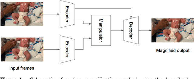 Figure 1 for Little Motion, Big Results: Using Motion Magnification to Reveal Subtle Tremors in Infants