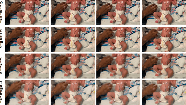 Figure 2 for Little Motion, Big Results: Using Motion Magnification to Reveal Subtle Tremors in Infants