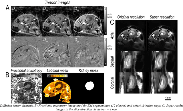 Figure 3 for Kidney segmentation using 3D U-Net localized with Expectation Maximization