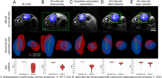Figure 4 for Kidney segmentation using 3D U-Net localized with Expectation Maximization