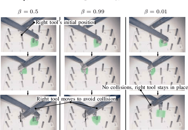 Figure 2 for A Unified Framework for the Teleoperation of Surgical Robots in Constrained Workspaces