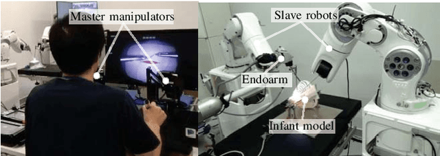 Figure 4 for A Unified Framework for the Teleoperation of Surgical Robots in Constrained Workspaces