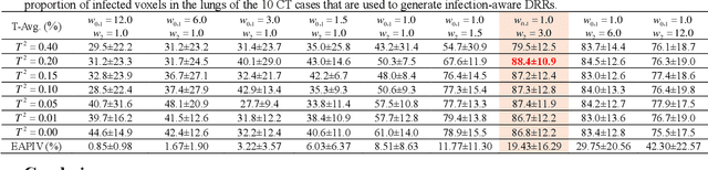 Figure 4 for DRR4Covid: Learning Automated COVID-19 Infection Segmentation from Digitally Reconstructed Radiographs