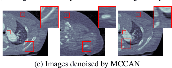 Figure 4 for Multi-Cycle-Consistent Adversarial Networks for CT Image Denoising