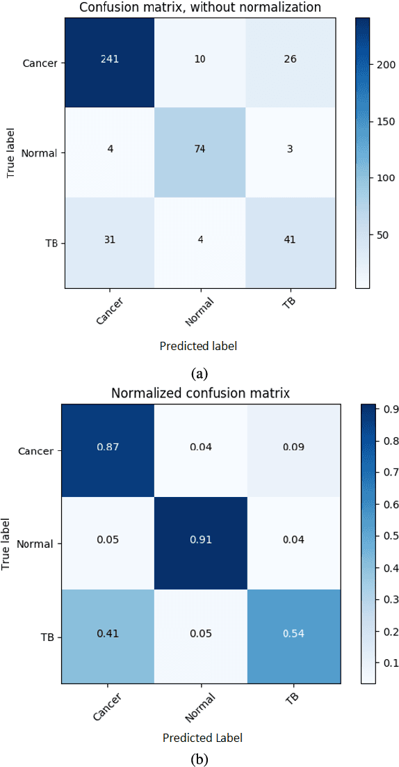 Figure 4 for Optimize transfer learning for lung diseases in bronchoscopy using a new concept: sequential fine-tuning