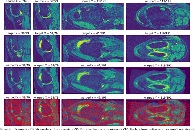 Figure 4 for Networks for Joint Affine and Non-parametric Image Registration