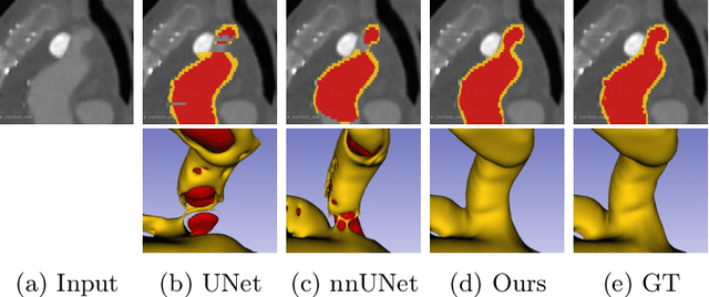 Figure 1 for Learning Topological Interactions for Multi-Class Medical Image Segmentation