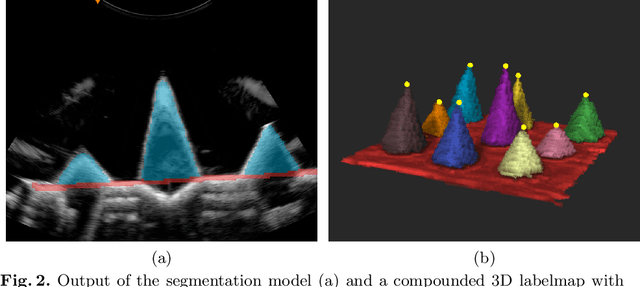 Figure 3 for PRO-TIP: Phantom for RObust automatic ultrasound calibration by TIP detection
