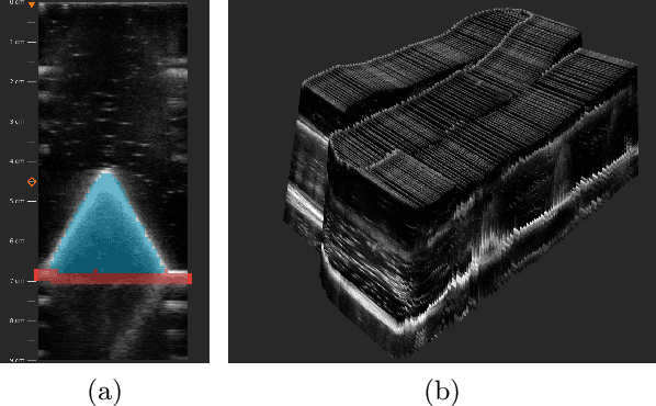 Figure 4 for PRO-TIP: Phantom for RObust automatic ultrasound calibration by TIP detection