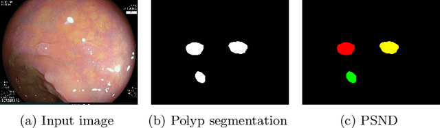 Figure 1 for NeoUNet: Towards accurate colon polyp segmentation and neoplasm detection