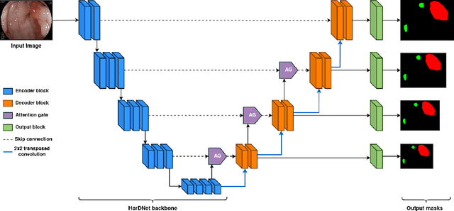 Figure 3 for NeoUNet: Towards accurate colon polyp segmentation and neoplasm detection