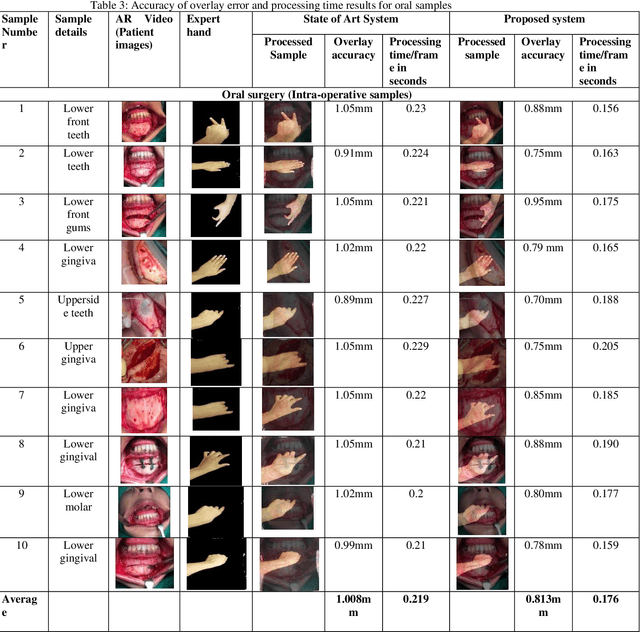 Figure 4 for A Novel Solution of Using Mixed Reality in Bowel and Oral and Maxillofacial Surgical Telepresence: 3D Mean Value Cloning algorithm