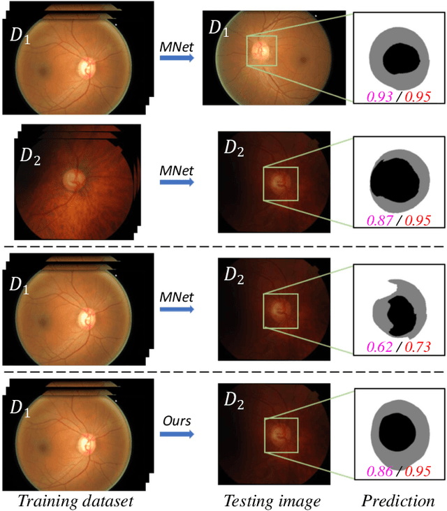 Figure 1 for Patch-based Output Space Adversarial Learning for Joint Optic Disc and Cup Segmentation