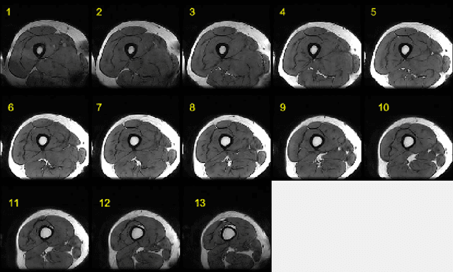 Figure 1 for Semantic Segmentation of Human Thigh Quadriceps Muscle in Magnetic Resonance Images