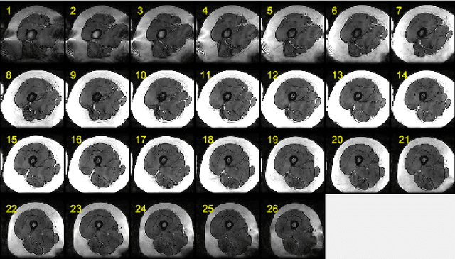 Figure 3 for Semantic Segmentation of Human Thigh Quadriceps Muscle in Magnetic Resonance Images