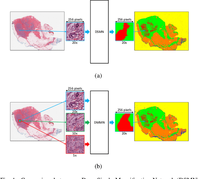 Figure 1 for Deep Multi-Magnification Networks for Multi-Class Breast Cancer Image Segmentation