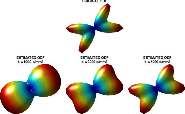 Figure 1 for Spatially regularized reconstruction of fibre orientation distributions in the presence of isotropic diffusion
