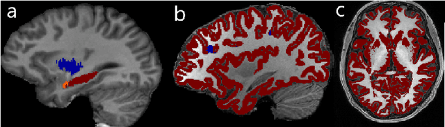 Figure 1 for Few-shot brain segmentation from weakly labeled data with deep heteroscedastic multi-task networks
