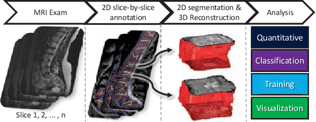 Figure 1 for 3DBGrowth: volumetric vertebrae segmentation and reconstruction in magnetic resonance imaging