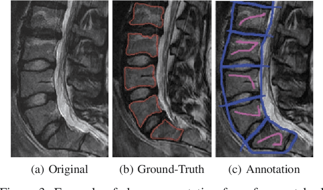 Figure 3 for 3DBGrowth: volumetric vertebrae segmentation and reconstruction in magnetic resonance imaging