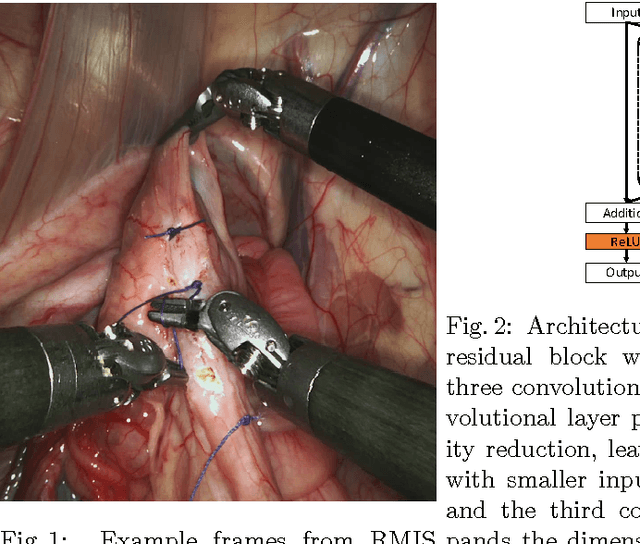 Figure 2 for Deep Residual Learning for Instrument Segmentation in Robotic Surgery