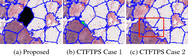 Figure 1 for "RAPID" Regions-of-Interest Detection In Big Histopathological Images