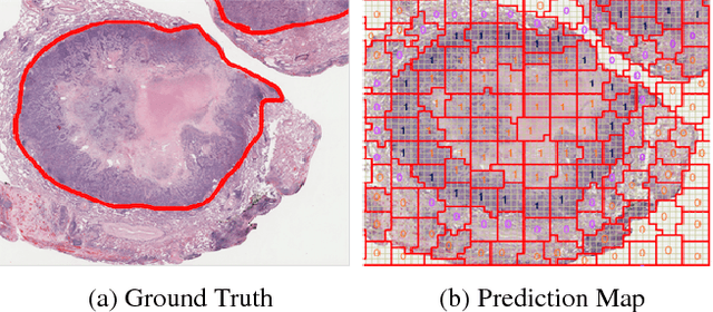 Figure 2 for "RAPID" Regions-of-Interest Detection In Big Histopathological Images